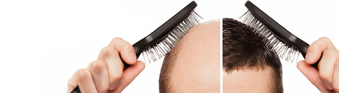 STRYDOM ACADEMY HAIR RESTORATION